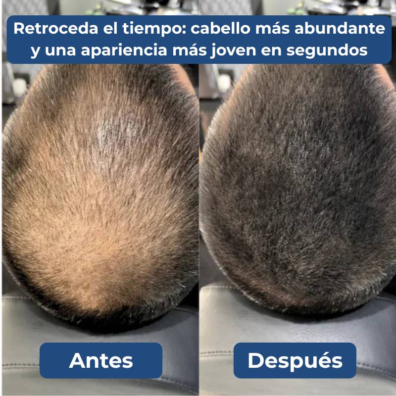 Densify™ - Corrector Capilar