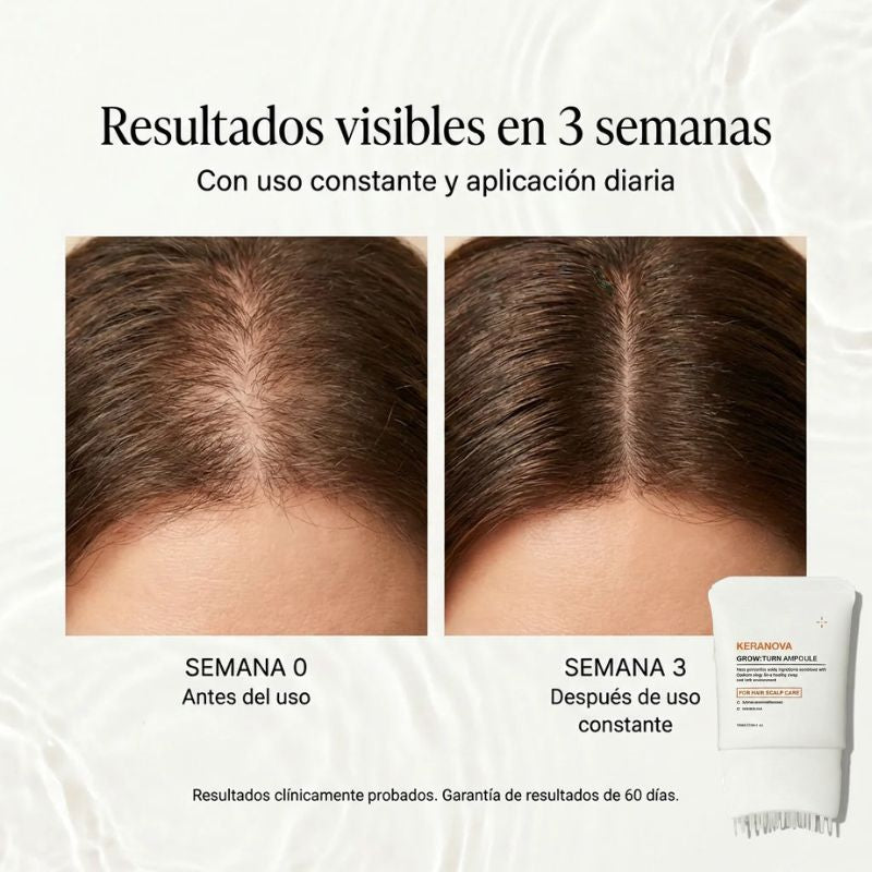 Keranova® - Sérum Activador Capilar