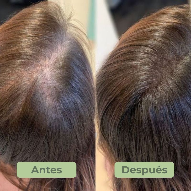 BioSha® | Champú orgánico para el crecimiento del cabello