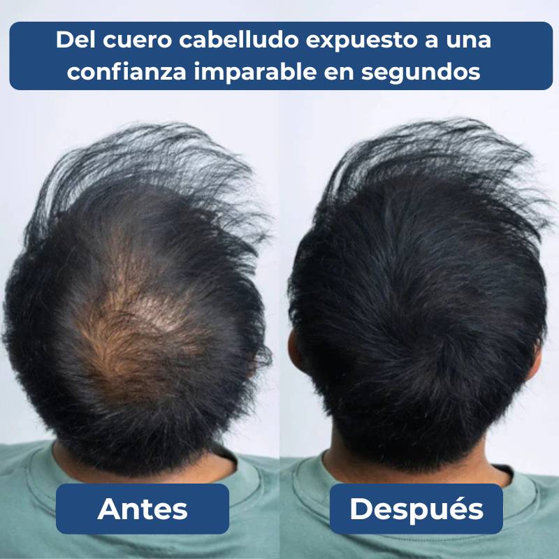 Densify™ - Corrector Capilar
