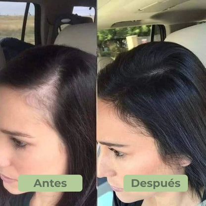 BioSha® | Champú orgánico para el crecimiento del cabello